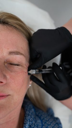 What Causes Crepey Skin?