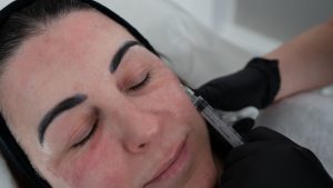 Dr Rachel  - why doctor-led under-eye treatment matters