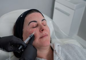 Dr Rachel - Why doctor-led under-eye treatment matters
